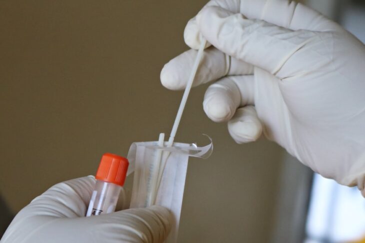 Clamoroso! la Cina comprò enormi lotti di test PCR MESI PRIMA della scoperta ufficiale del Covid!